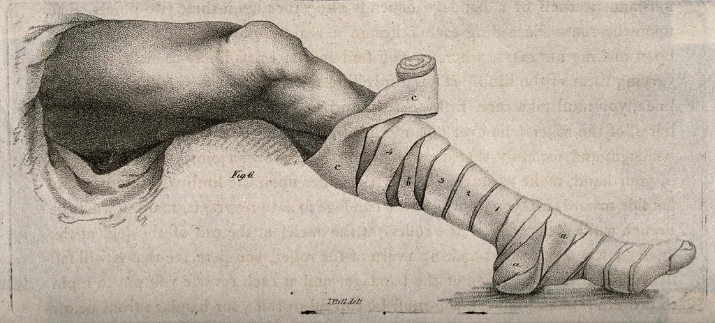 A knee support